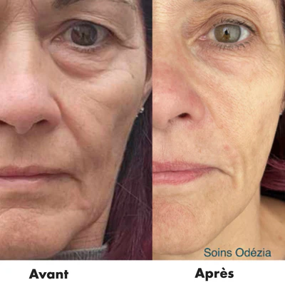Duo Gel Régénérant Anti-Âge Derma Collagen 60ml et Gel Fermeté Derma Elastin 60ml - RD COSMETIC