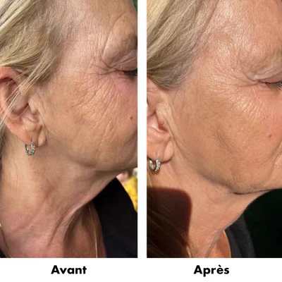 Duo Gel Régénérant Anti-Âge Derma Collagen 60ml et Gel Fermeté Derma Elastin 60ml - RD COSMETIC