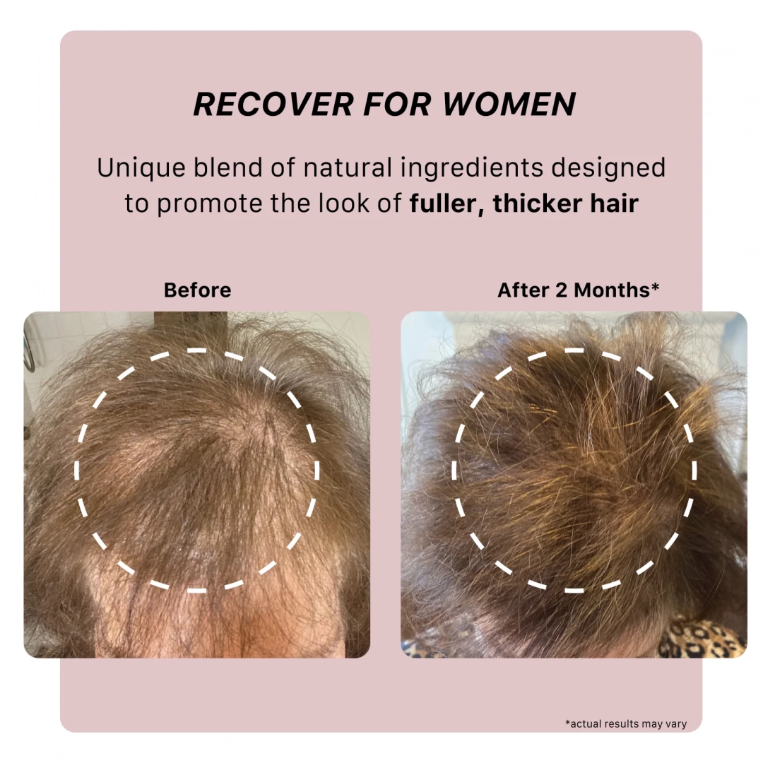 RECOVER WOMEN DUO FORMAT VOYAGE 80ml- ACTI/V