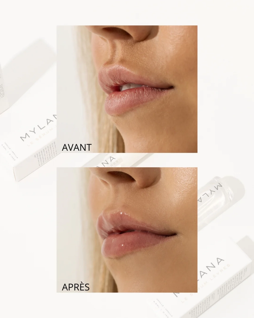 Le sérum Lèvres - MYLANA