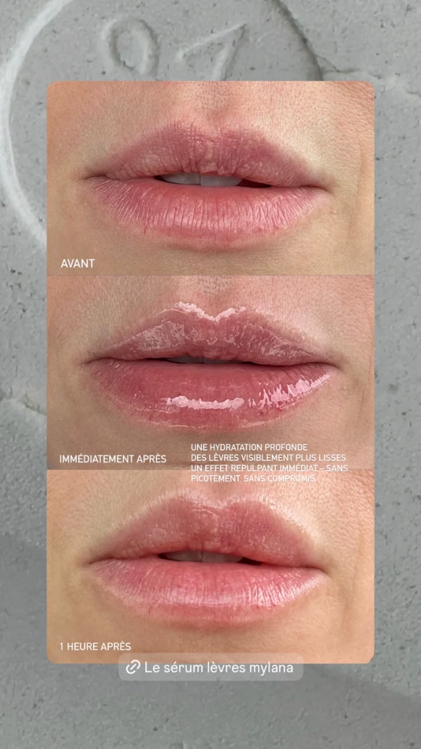Le sérum Lèvres - MYLANA