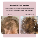 RECOVER SHAMPOOING TRAITANT ÉPAISSISSANT POUR FEMMES - ACTIIV