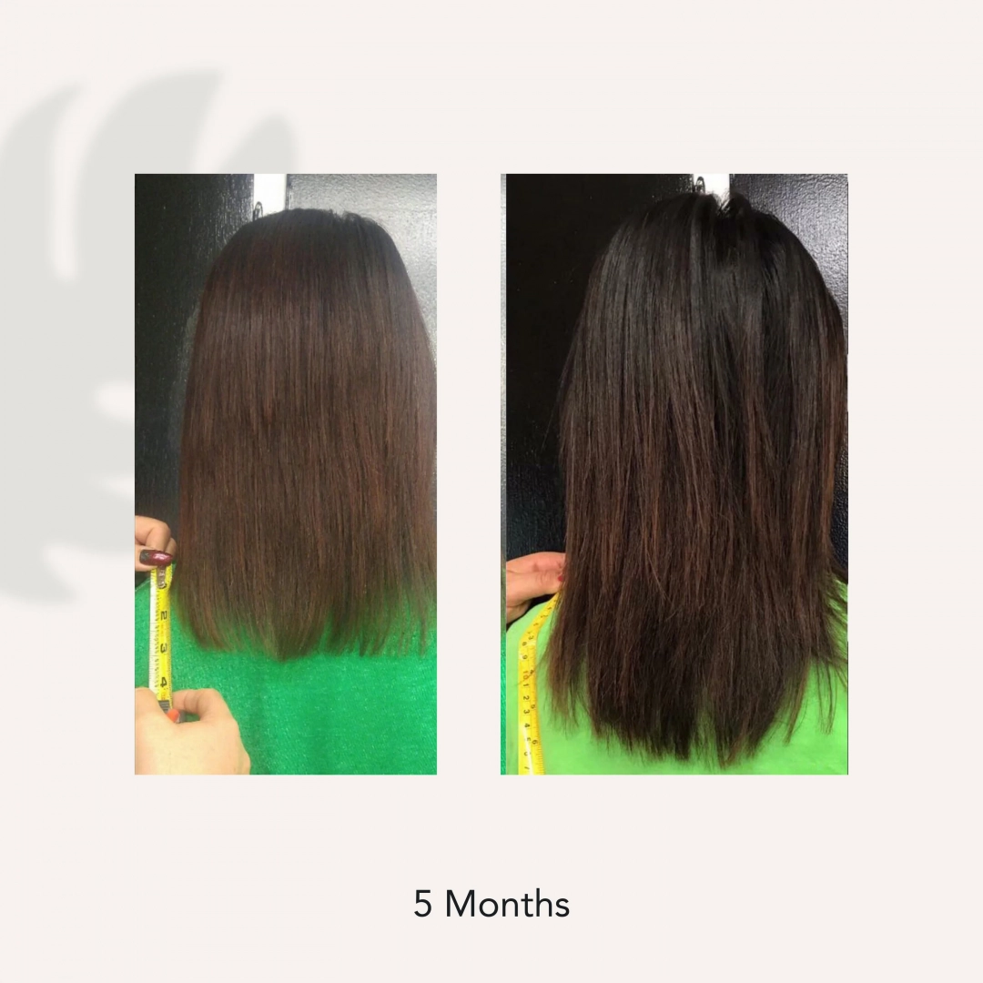 RENEW HEALING CONDITIONER - ACTI/V